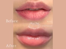 クリアー(CLEAR.)/【Before＆After】ローマピンク