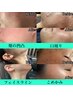 【ハーブピーリング】つや肌・毛穴ケアに★REVI陶肌トリートメント2ｇ 90分