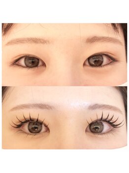 リガール(LIGAR)/Before→After★