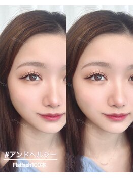 セリーナ 大橋店(CERINA)/アンドヘルシー100本/YUINA