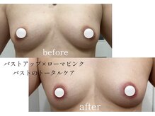 サロンド ハイラント(salon de heiland)の雰囲気(バストメニュー×ローマピンクであの頃のバストに戻せるサロン。)