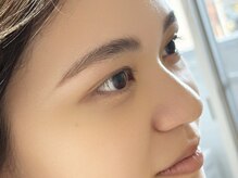 アルシスタ(ARCISTA)