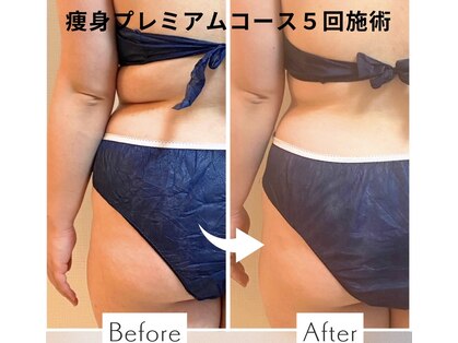 ヨサパーク すずのね(YOSA PARK)の写真