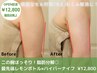★今春限定10名★《二の腕ほっそり》脂肪分解レモンボトル×ハイパーナイフ
