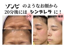 アルルプラス 南草津(ARuru+)/ヴァンパイアマスク