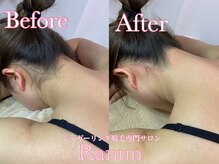 ラナン(Ranun)/細くて長い美しいうなじの完成