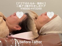 ソワン ド ブランシュ ライフ八戸ノ里店(Soin de Blanche)/大切なお出かけに向けての肌ケア