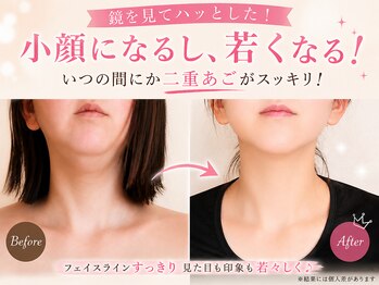 ヨサパーク アカーシャ(YOSA PARK AKASHA)/テラキューブで小顔実感!