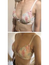 レイア 中城店(RayA)/本気の育乳コース☆3-6ヶ月