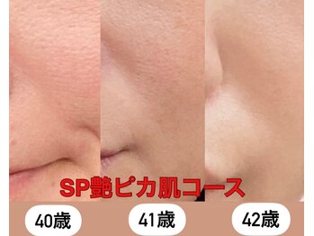 ちゅるん肌.com なかもず店