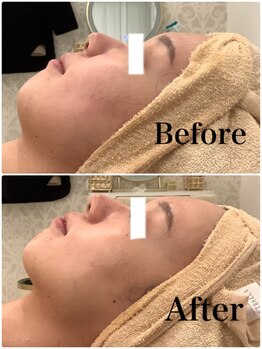 スペチアーレ 夙川/驚きの引き上がり