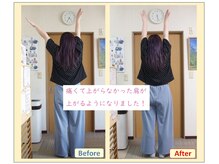 ひらばり ハッピー整体/肩こりの方のビフォー＆アフター