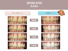 通うたびに輝く白い歯に☆清潔感がアップ♪若々しい印象に♪