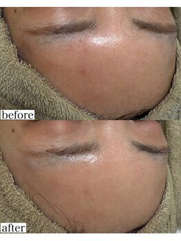 モンクラッシー(Mon classy)/