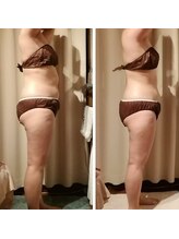 サクラス(SUQRAS)/ビフォーアフター/8回