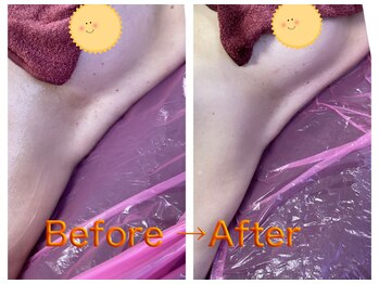 エステティックサロン ココチ(Cocochi)/ラジオ波+キャビテーション