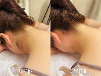 ビーグラム(B.GLAM)/シュガーリング／うなじ