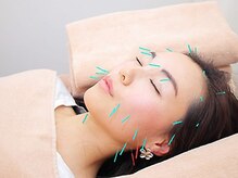 ピアーズ鍼灸整骨院