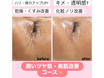 エトワール(Etoile)の写真