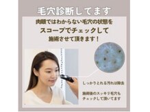 マヴィ 香里園店(MavY.)/肌状態をチェック