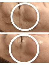 ベルジェ(Bellje)/*最新光フォト*