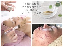 ラニホク