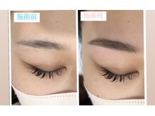 エステティック アントワネット/ハリウッドブロウリフト