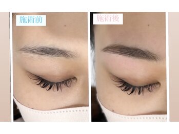 エステティック アントワネット/ハリウッドブロウリフト