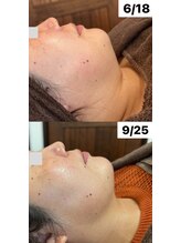 サロン サルー(SALON Salud)/◇再生美容