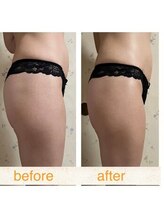 ラレコルト/ビフォーアフター