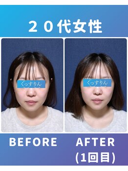 ぐっすりん/初回体験のお客様の変化(2)