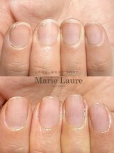 マリーロール 梅田店(Marie Laure)/深爪改善/自爪育成/ネイルケア