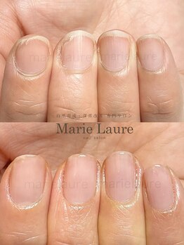マリーロール 梅田店(Marie Laure)/深爪改善/自爪育成/ネイルケア