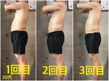 ペリー(PELLY)/男性20代　before after