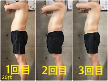 ペリー(PELLY)/男性20代 before after