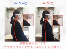 タイナ 岡山(taina)/猫背・巻き肩矯正