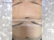 ノノサロン(nono salon)/