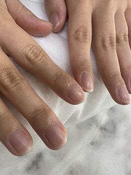 アンドネイルアンドビューティー(&NAIL and Beauty)/ビフォー　甘皮あり
