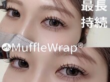 ベンガレンシス ファーストネイル(Benghalensis/1st NAIL)