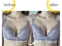 ラジュワード(lajward)の雰囲気（１度の施術でここまで変わる！デコルテもっちり溢れるバスト）