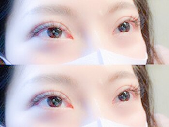 ナナ 福岡(NANA)/3Dラッシュ