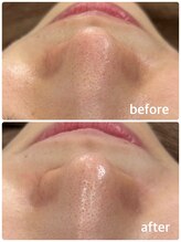 ナナ整骨鍼灸院 ココ(Nana整骨鍼灸院 Coco)/光フェイシャル