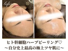 ミタメ 銀座店(MITAME)の雰囲気（艶肌/ニキビケア/肌質改善にハーブ◎ファンデ卒業！素肌美人に♪）