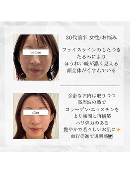 メディカルエステ 東銀座店/30代前半 女性