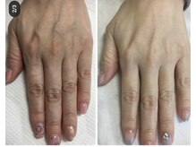 エムフルール(M fleur)/ハンドトリートメント