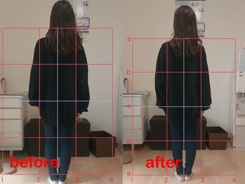 ゆずのき/マタニティカイロbefore after