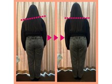 キララ 美容矯正/全身の歪み改善