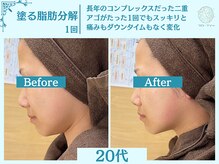 フローフシ∞/【小顔】塗る脂肪分解&燃焼