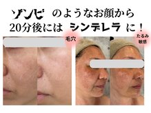 アルルプラス 南草津(ARuru+)/ヴァンパイアマスク