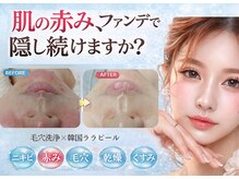 ウェリナベル(WelinaBelle)